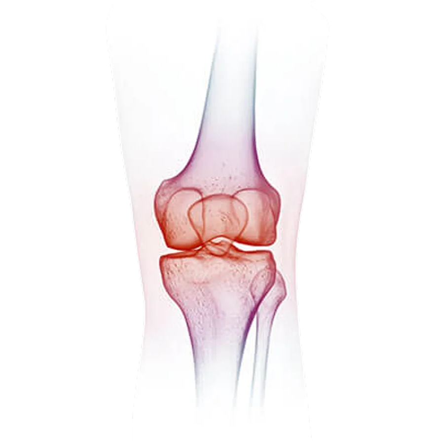Knee pain treatment options in Patna including physiotherapy injection and knee replacement